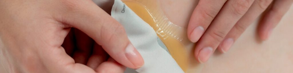importaciones quirurgicas, iq, colostomia, ostomia, chile, oftalmología, especialidades medicas, coloplast, estoma, placa, disco, convexo, swiss roll convexo, swiss roll plano, disco ostomia extra adhesivo, 40mm, 60mm, plano, dioptria, urostomia, ileostomia, drenable, transparente, opaca, bolsa, operatorio, urologia, continencia, pediatrica, hidrocoloide, hidrogel, swiss roll, protector cutaneo, fistula, sonda prostatica, prótesis peneana, cateter, estuche peneal, tapon anal, toallita protectora, santiago, chile, las condes, insumos medicos, insumos para operación, herida, tratamiento para heridas, lente intraocular, ipcl, Implantable Phakic Contact Lens, Alta dioptria, presbyoptic, presbioptico, Toric, torico, torico alta dioptria, genesis prótesis peneana maleable, prótesis peneana maleable, catéter perrcutaneo, sonda prostatica, sonda prostatica couvelaire balon, guia dormia no tip, guía catéter doble j, balón de dilatación, estuche penal, toallita protectora conveen, easicath, cateter con revestimiento hidrofilico, catéter lubricado, barreras para colostomia, barreras de colostomia, base para colostomia, bolsa colostomia 2 piezas, bolsa convexa para colostomia, bolsa convexa para ileostomia, bolsa de colostomia 2 piezas, bolsa de colostomia 2 piezas, bolsa de colostomia con base, bolsa de colostomia con drenaje, bolsa de colostomia con filtro, bolsa de colostomia con placa, bolsa de colostomia de dos piezas, bolsa de colostomia de una pieza, bolsa de colostomia dos piezas, bolsa de colostomia llena, bolsa de colostomia para adulto, bolsa de colostomia pediatrica, bolsa de colostomia precio, bolsa de drenaje de colostomia, bolsa de ostomia, bolsa de ostomía abierta, bolsa de ostomía, bolsa de ostomia de dos piezas, bolsa de ostomia de una pieza, bolsa drenable para ostomia, bolsa ileostomia, bolsa ostomia, bolsa para colostomia, bolsa para colostomia pediatrica, bolsa para ostomia, bolsa para urostomia, bolsas colostomia, bolsas colostomia para bebes, bolsas colostomía, bolsas colostomia pediatricas, bolsas de colostomia, bolsas de colostomia convexas, bolsas de colostomia infantil, bolsas de colostomia para bebe, bolsas de ileostomia, bolsas de ostomia tipos, bolsas para colostomia con filtro, bolsas para colostomia pediatrica, bolsas para estomas, bolsas para ileostomia, bolsas y barreras para colostomia, bolsita de colostomia, colocación de bolsa de colostomia, colostomia bolsa, colostomia bolsa llena, colostomia ileostomia, colostomia ostomia, colostomia y ileostomia, colostomia y urostomia, desodorante para bolsas colostomia, disco colostomia, disco de colostomia, dispositivo de ostomia, dispositivos para ostomias, drenaje colostomia, drenaje de bolsa de colostomia, drenaje de colostomia, equipo para colostomía, estoma urostomia, hollister colostomia, ileostomia bolsa, ostomia colostomia, para que se usa la bolsa de colostomia, parche colostomia, placa colostomia, placa colostomia convexa, placa convexa ostomia, placa de ostomia, placa ostomia, placa para colostomia, poner bolsa de colostomia, productos de colostomia, tipo de bolsas de colostomia, tipos de bolsa colostomia, tipos de bolsa para colostomia, tipos de bolsas de ostomia, tipos de bolsas para colostomia, Santiago, Las Condes, Chile, Valparaiso, Concepcion, Talca, Puerto Varas, Puerto Montt, Punta Arenas, Viña del Mar, La Serena, Iquique, Antofagasta